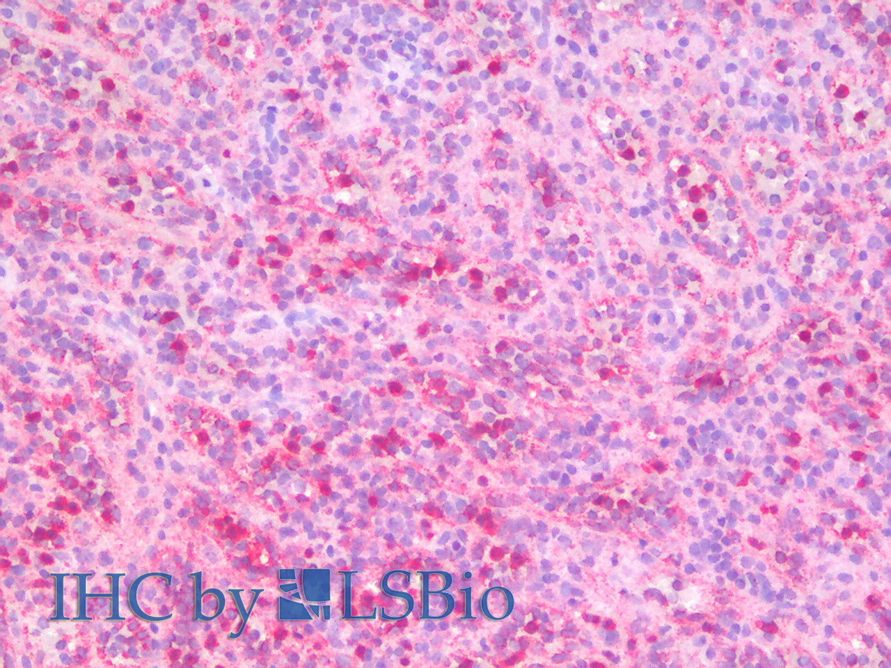 Immunohistochemistry analysis of paraffin-embedded Human Spleen using ITGAX Polyclonal Antibody(Elabscience® Product Detected by Lifespan).