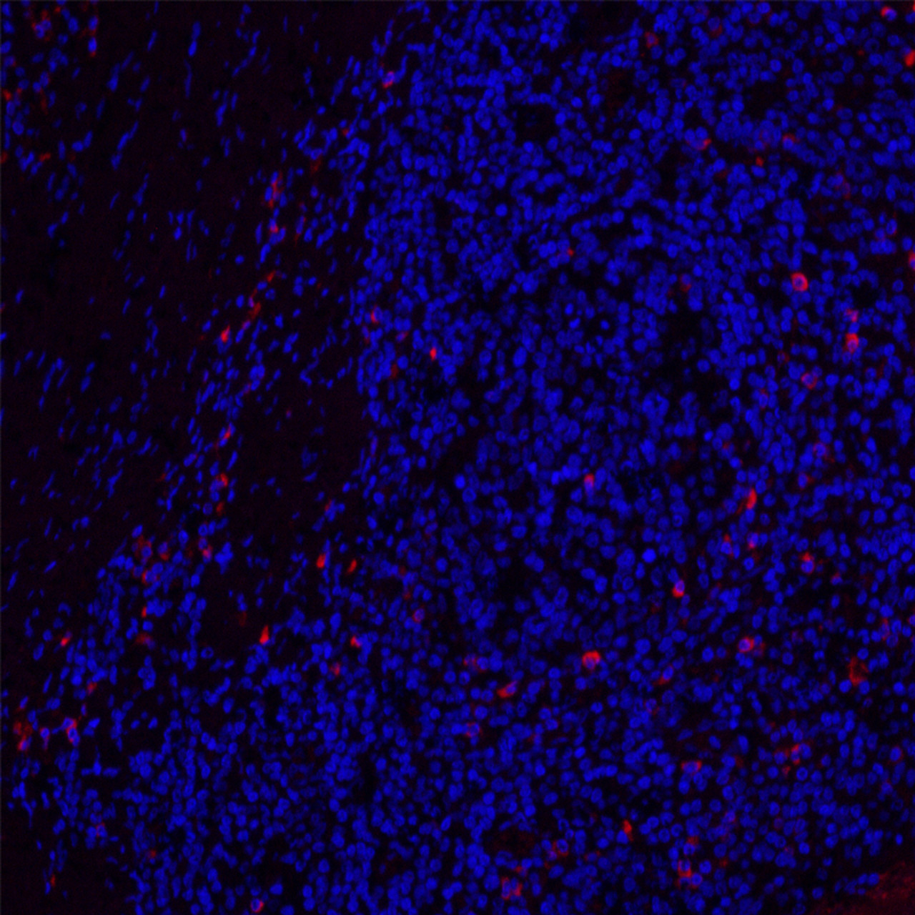 Immunofluorescence analysis of paraffin-embedded Human tonsil  using CD19 Polyclonal Antibody at dilution of 1:200.