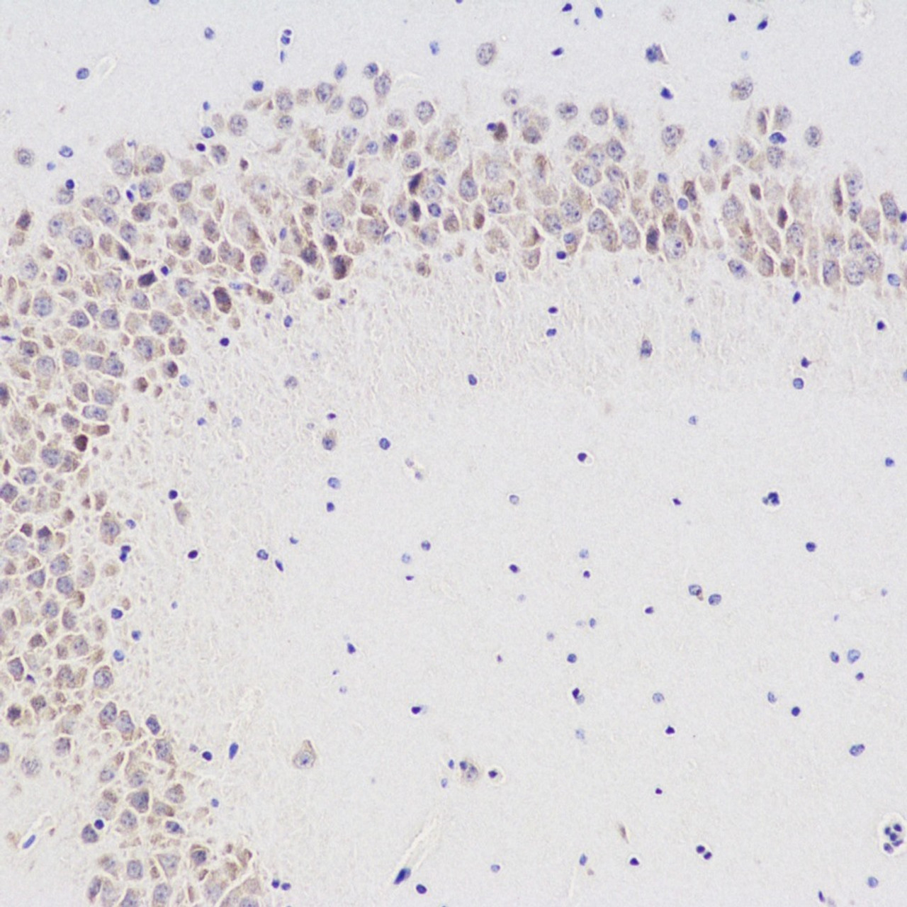 Immunohistochemistry analysis of paraffin-embedded mouse brain  using CHAT Polyclonal Antibody at dilution of 1:300.