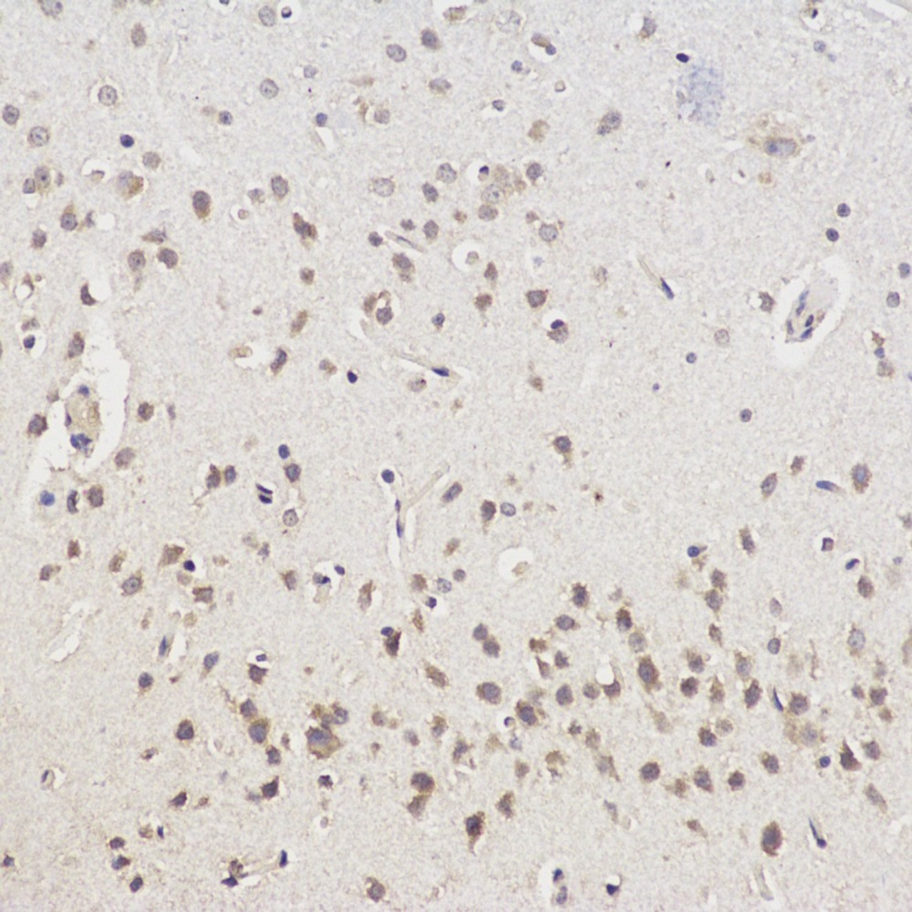 Immunohistochemistry analysis of paraffin-embedded Rat brain  using CHAT Polyclonal Antibody at dilution of 1:100.