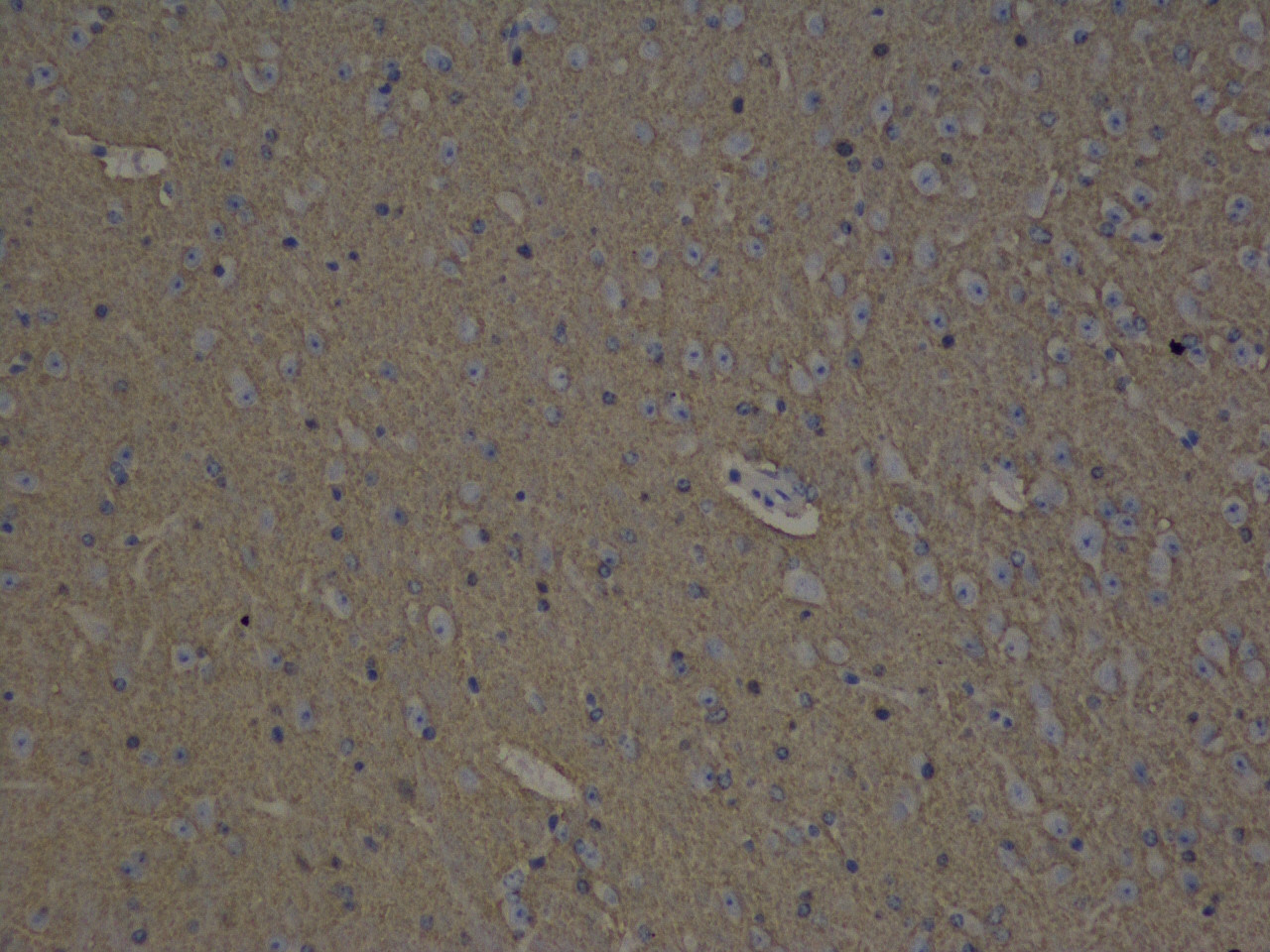 Immunohistochemistry analysis of paraffin-embedded mouse brain  using GAP43 Polyclonal Antibody at dilution of 1:300.