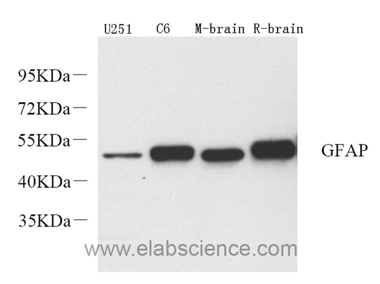 Western Blot analysis of various samples using GFAP Polyclonal Antibody at dilution of 1:2000.