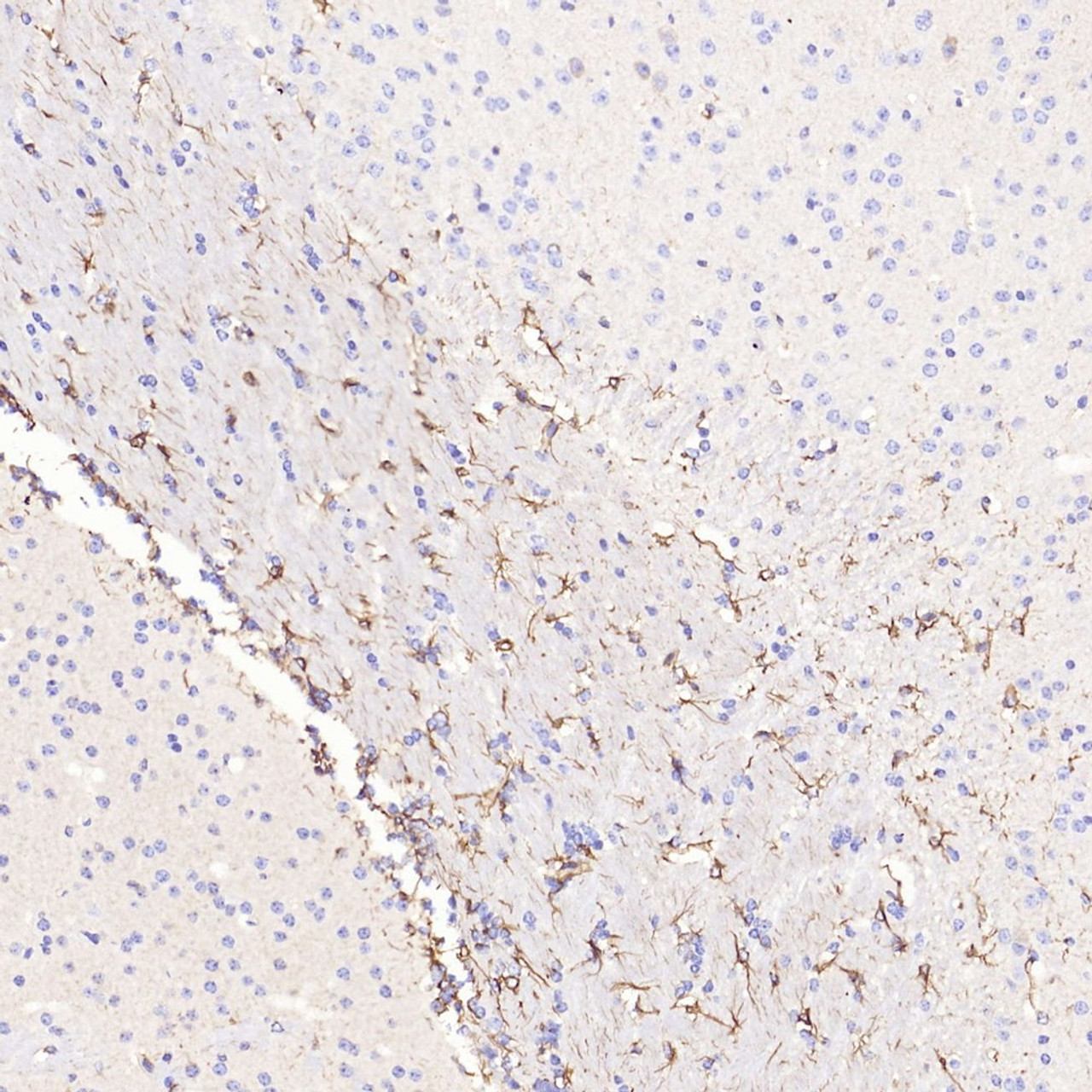 Immunohistochemistry analysis of paraffin-embedded mouse brain  using GFAP Polyclonal Antibody at dilution of 1:500.