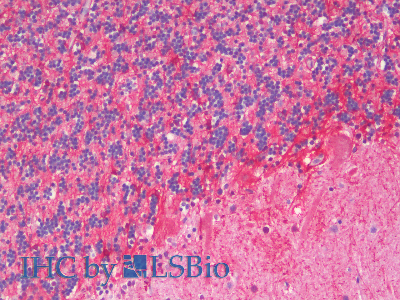 Immunohistochemistry analysis of paraffin-embedded Human Cerebellum using GFAP Polyclonal Antibody(Elabscience® Product Detected by Lifespan).