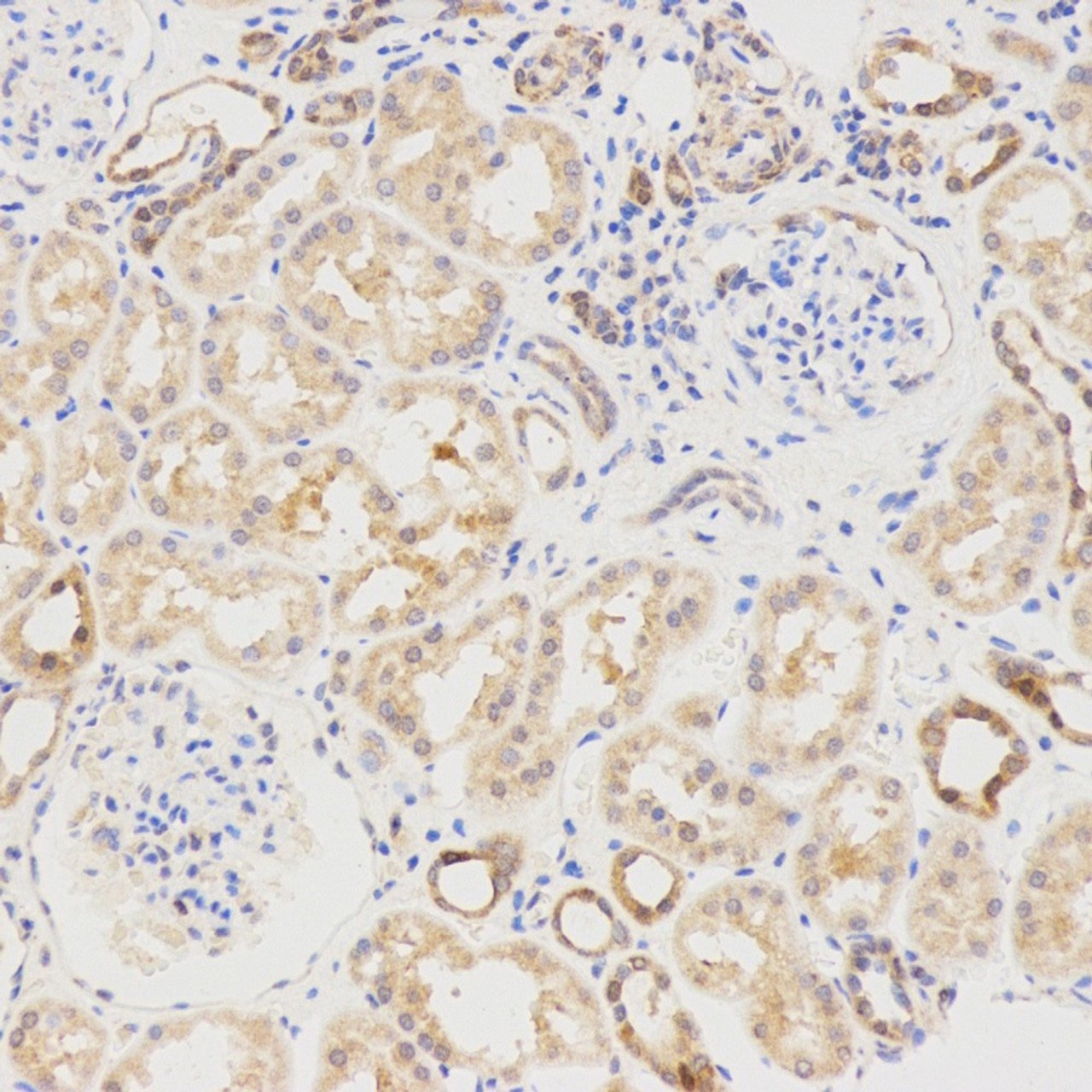 Immunohistochemistry analysis of paraffin-embedded Human spleen  using LC3A/B Polyclonal Antibody at dilution of 1:500.