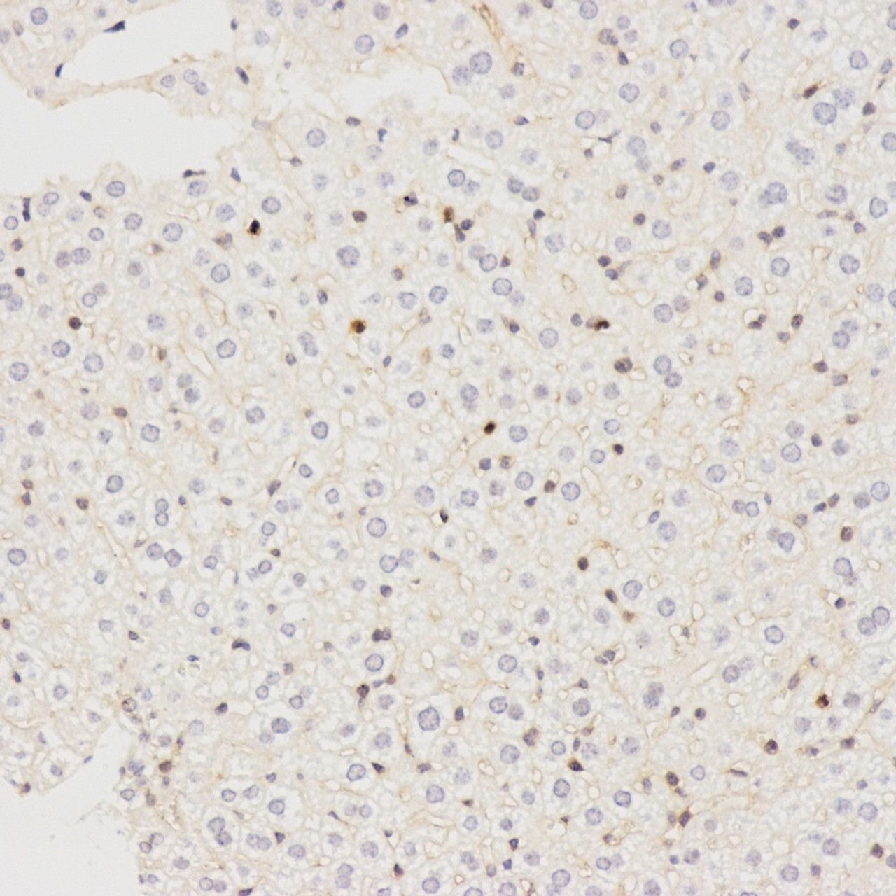 Immunohistochemistry analysis of paraffin-embedded mouse liver  using LC3A/B Polyclonal Antibody at dilution of 1:500.