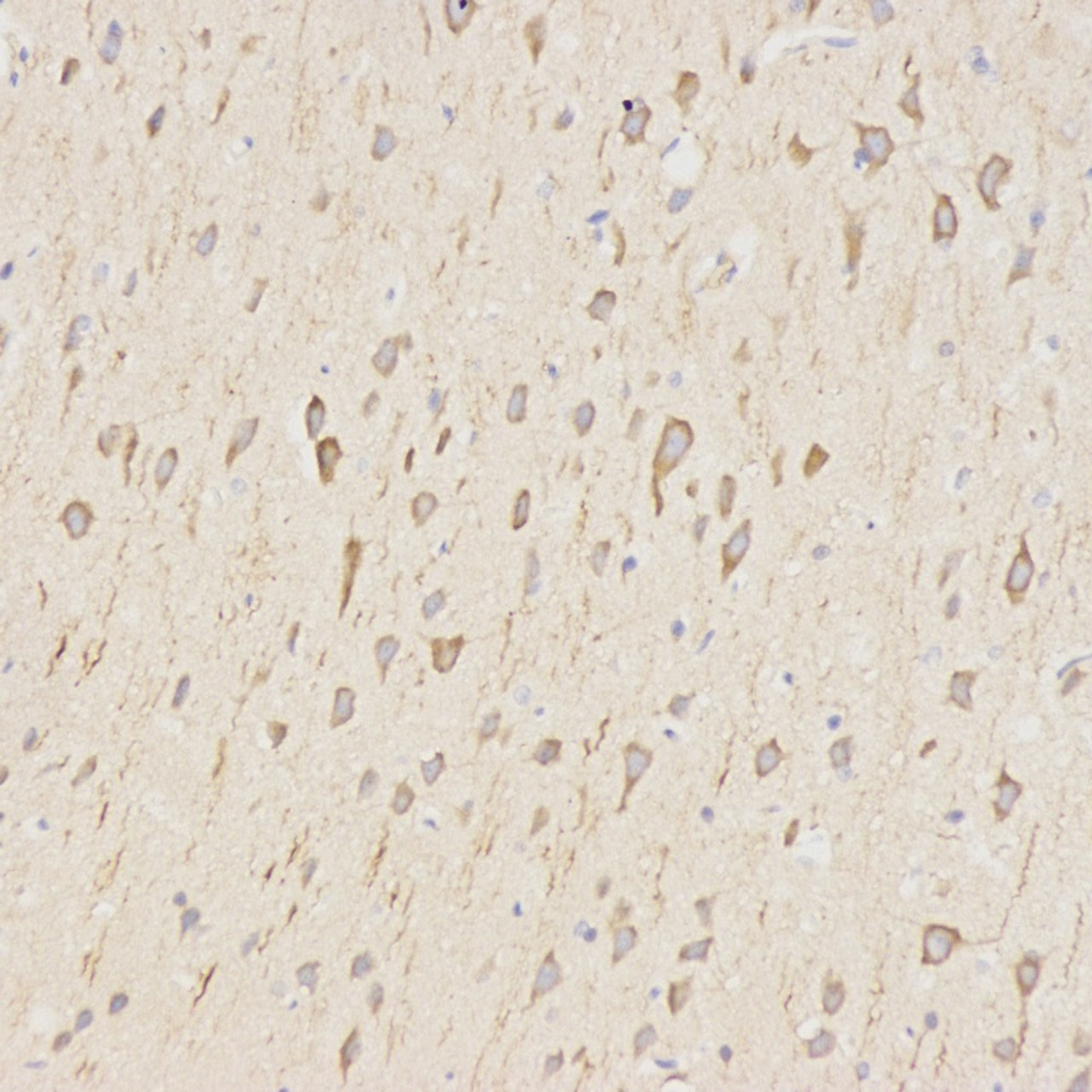 Immunohistochemistry analysis of paraffin-embedded rat brain  using LC3A/B Polyclonal Antibody at dilution of 1:500.