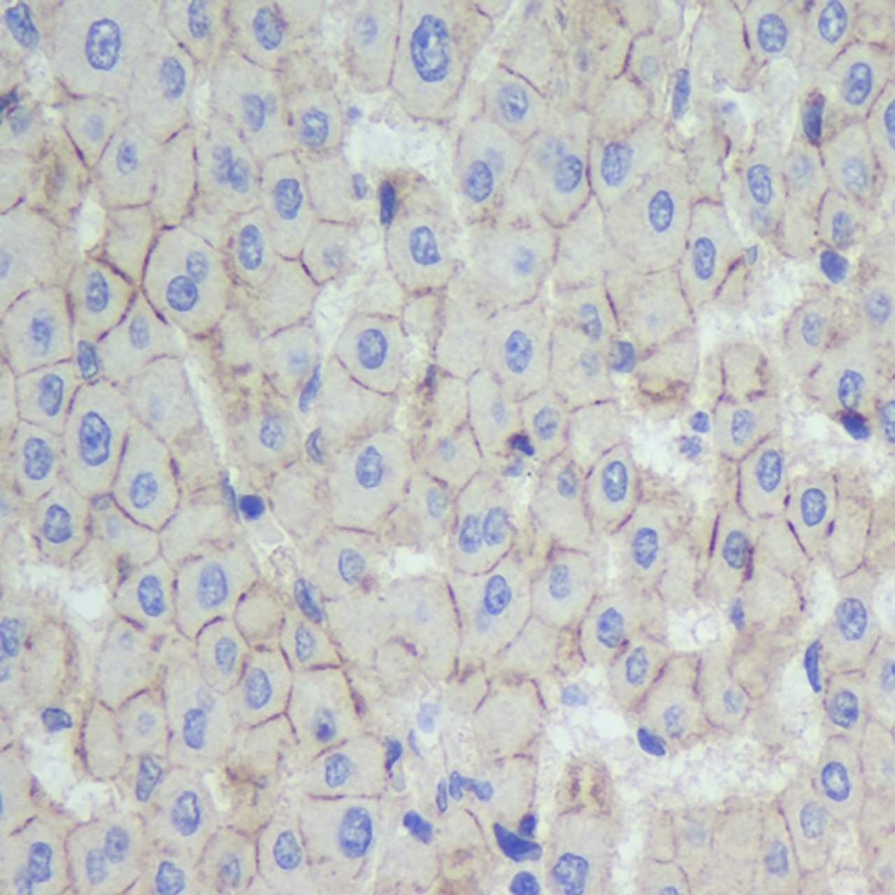 Immunohistochemistry analysis of paraffin-embedded human liver  using N-cadherin Polyclonal Antibody at dilution of 1:500.