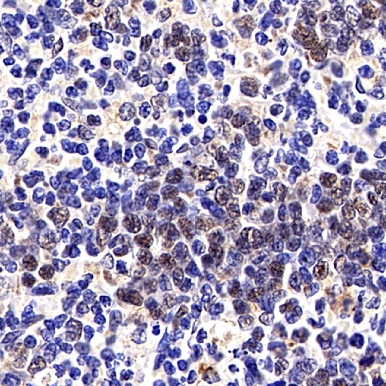 Immunohistochemistry analysis of paraffin-embedded Rat spleen cancer  using p27 Polyclonal Antibody at dilution of 1:200.