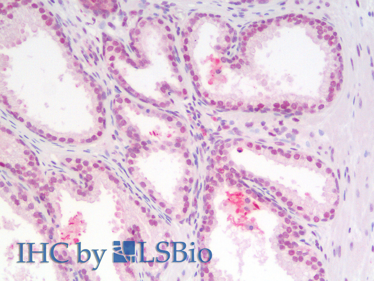 Immunohistochemistry analysis of paraffin-embedded Human Prostate using p27 Polyclonal Antibody(Elabscience® Product Detected by Lifespan).