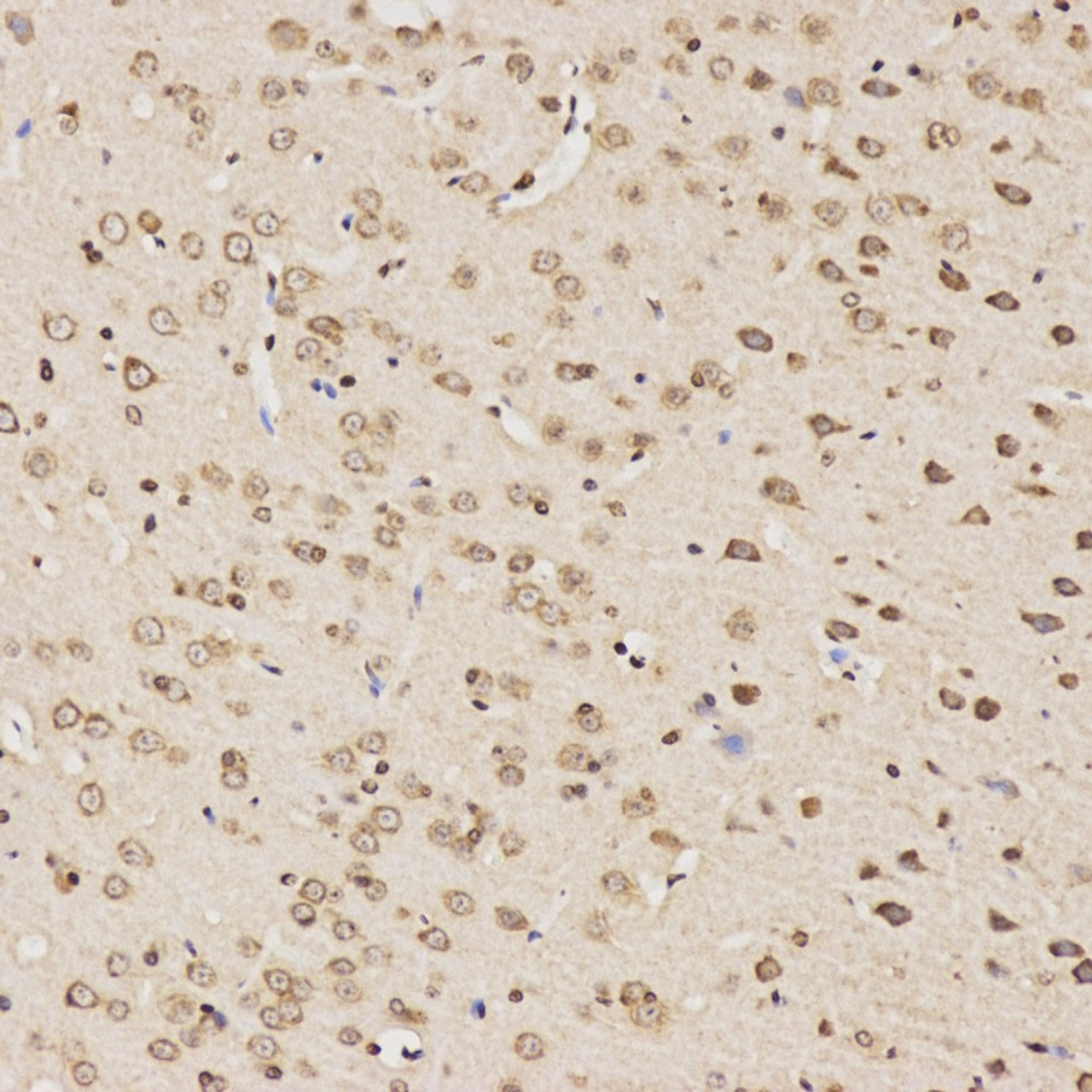 Immunohistochemistry analysis of paraffin-embedded rat brain  using Tau Polyclonal Antibody at dilution of 1:100.