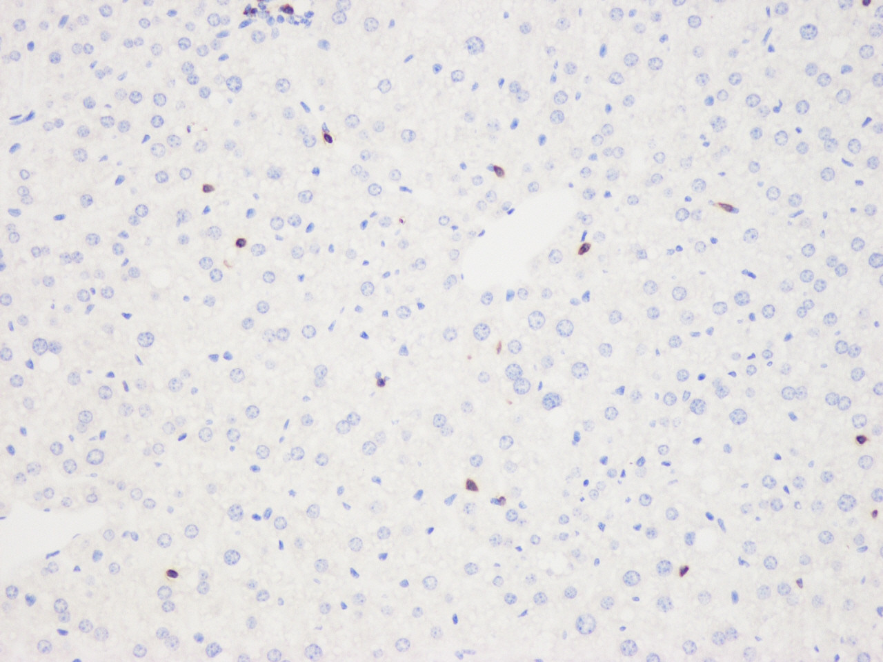 Immunohistochemistry analysis of paraffin-embedded mouse liver  using THY1 Polyclonal Antibody at dilution of 1:500.