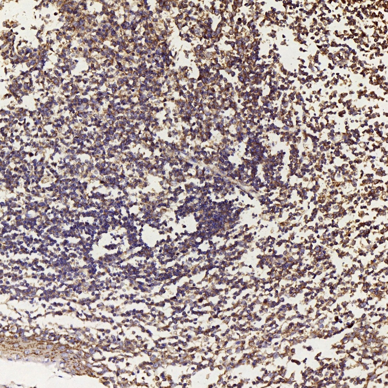Immunohistochemistry analysis of paraffin-embedded human tonsil  using BECN1 Polyclonal Antibody at dilution of 1:500.
