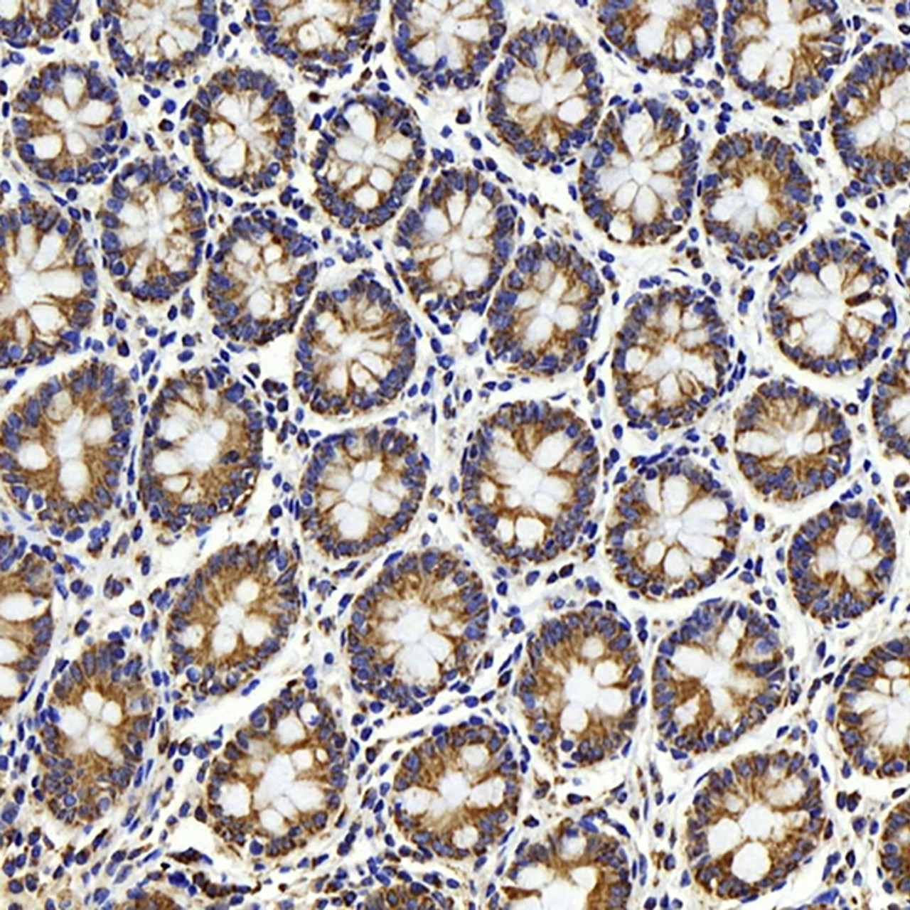 Immunohistochemistry analysis of paraffin-embedded human colon  using HSP60 Polyclonal Antibody at dilution of 1:500.