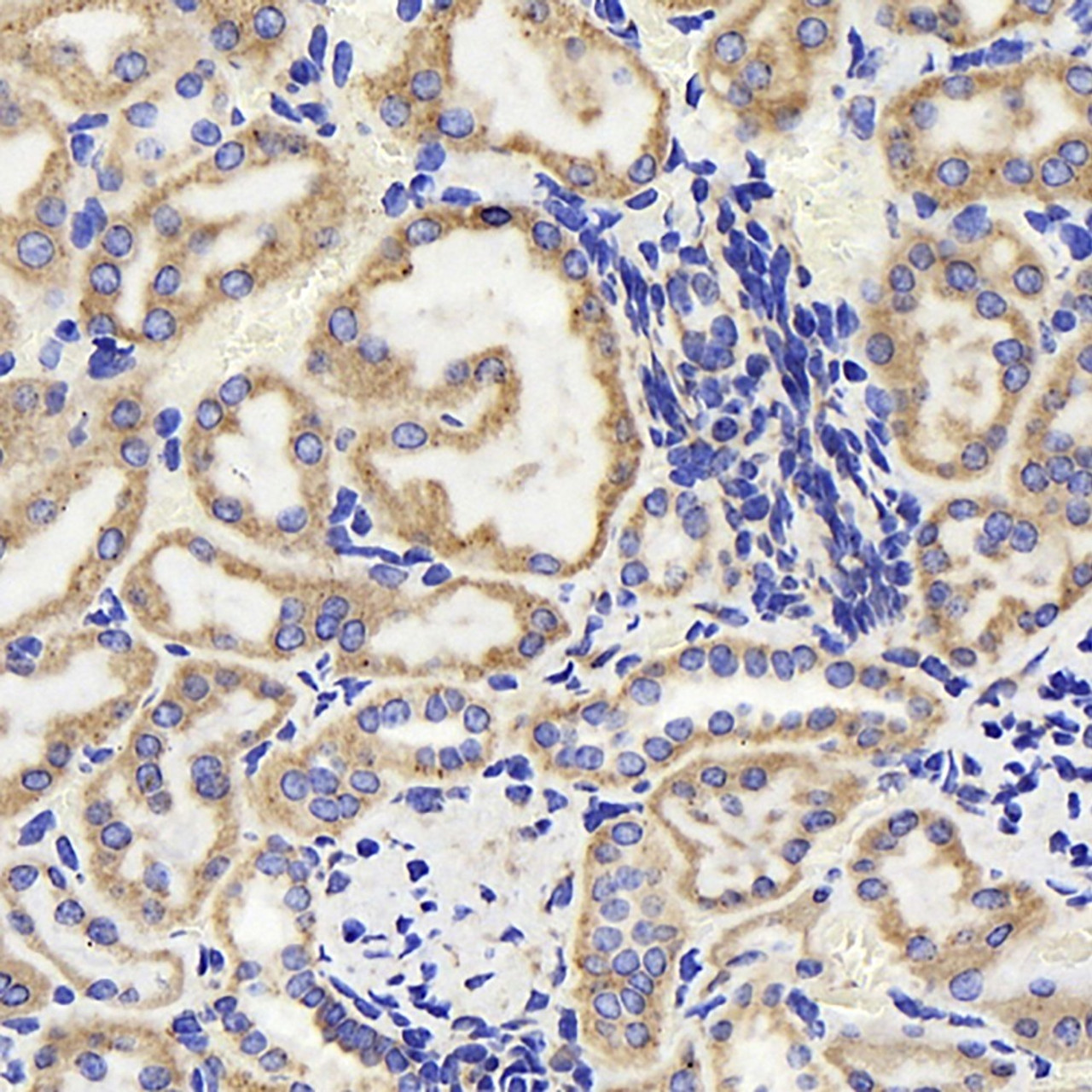 Immunohistochemistry analysis of paraffin-embedded Mouse kidney  using HSP60 Polyclonal Antibody at dilution of 1:500.