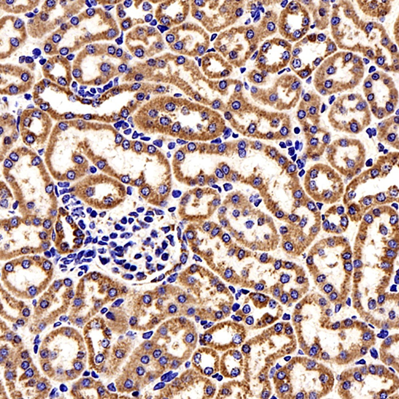 Immunohistochemistry analysis of paraffin-embedded Mouse kidney cancer  using COX4I1 Polyclonal Antibody at dilution of 1:200.