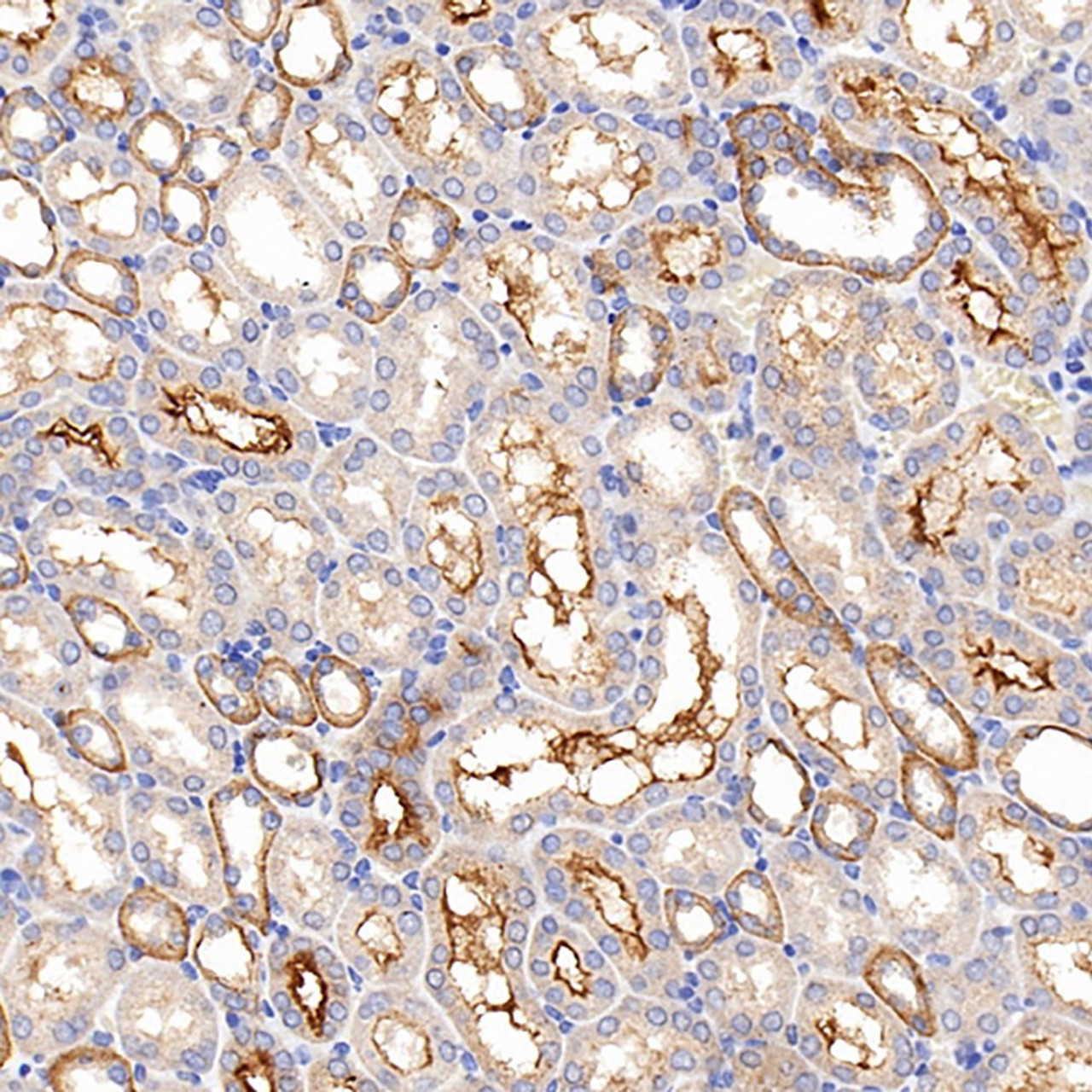 Immunohistochemistry analysis of paraffin-embedded mouse kidney  using CXCR7 Polyclonal Antibody at dilution of 1:200.