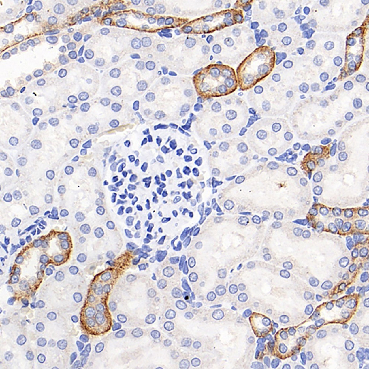 Immunohistochemistry analysis of paraffin-embedded rat kidney  using CXCR7 Polyclonal Antibody at dilution of 1:200.