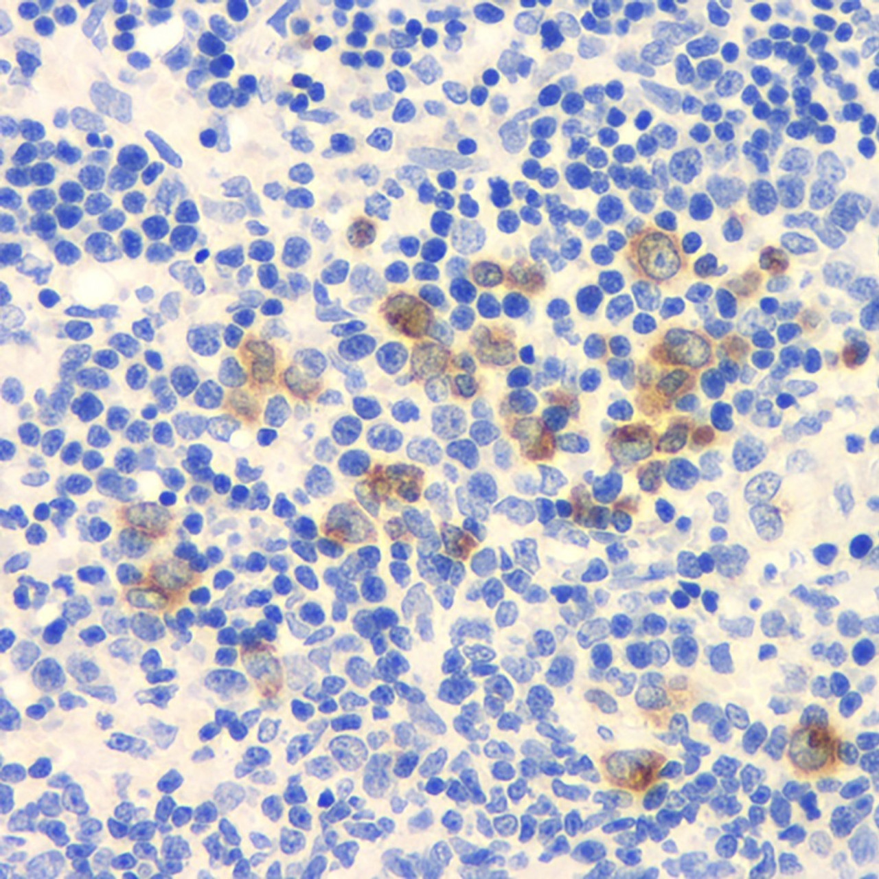 Immunohistochemistry analysis of paraffin-embedded rat spleen  using ROCK1 Polyclonal Antibody at dilution of 1:300.