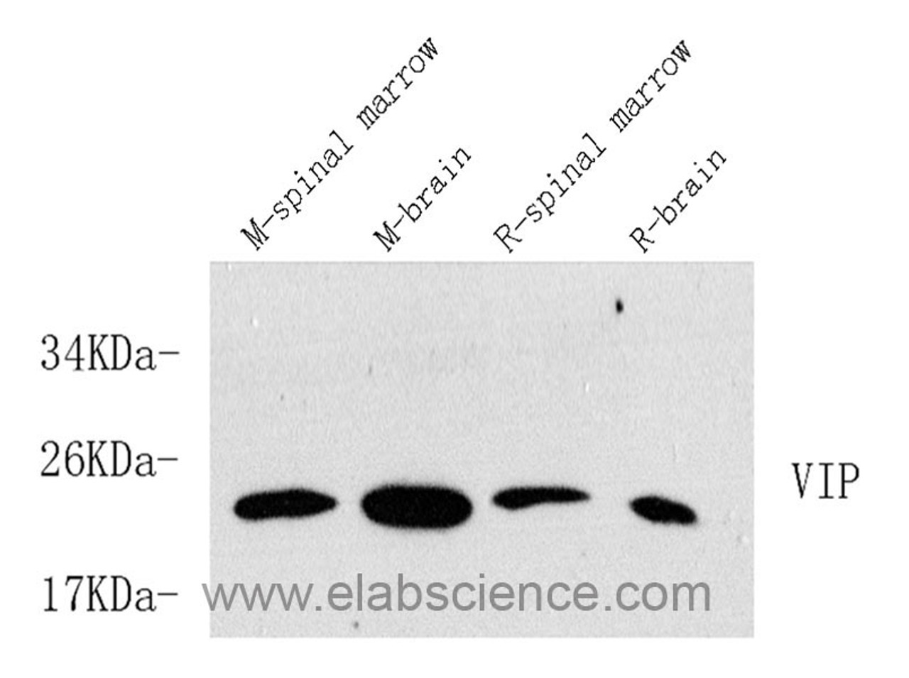 Western Blot analysis of various samples using VIP Polyclonal Antibody at dilution of 1:600.