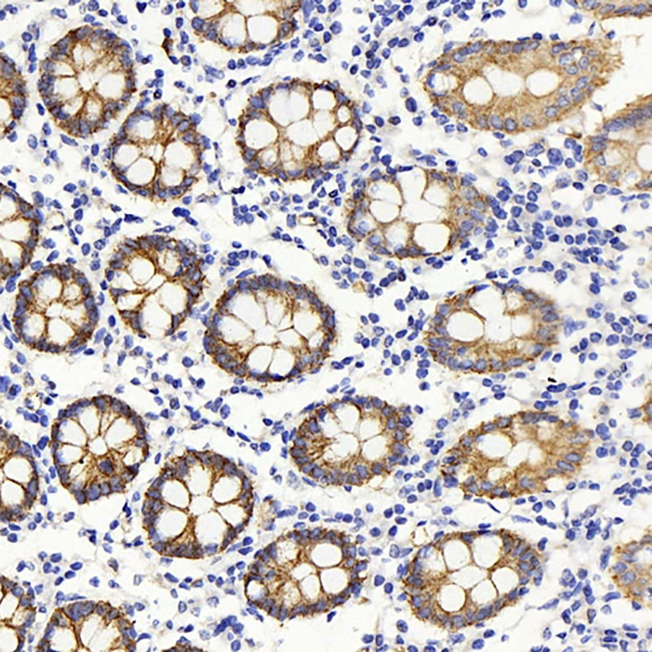 Immunohistochemistry analysis of paraffin-embedded human colon  using Claudin 5 Polyclonal Antibody at dilution of 1:400.