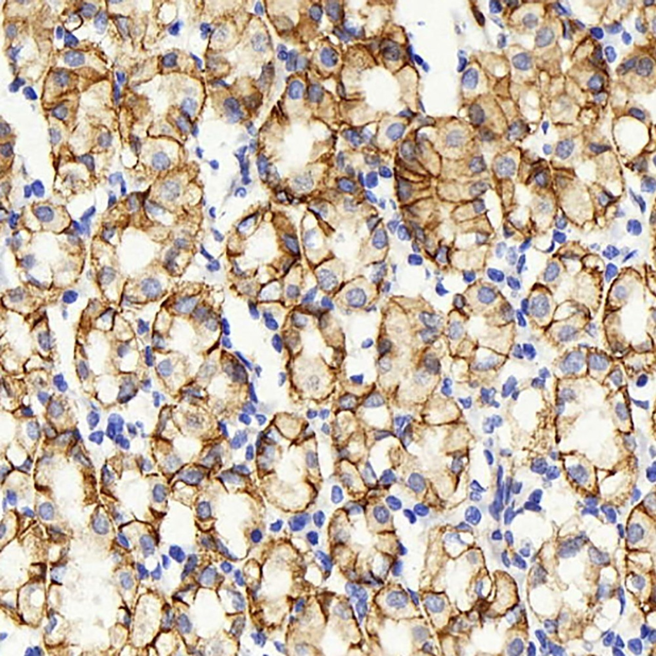 Immunohistochemistry analysis of paraffin-embedded human stomach  using Claudin 5 Polyclonal Antibody at dilution of 1:400.