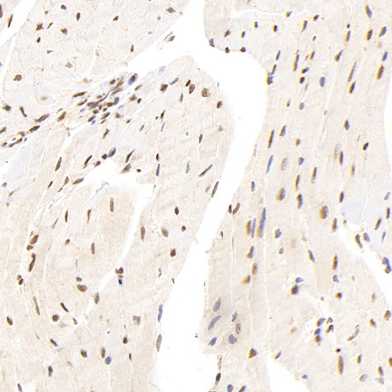 Immunohistochemistry analysis of paraffin-embedded mouse heart  using ATF6 Polyclonal Antibody at dilution of 1:400.