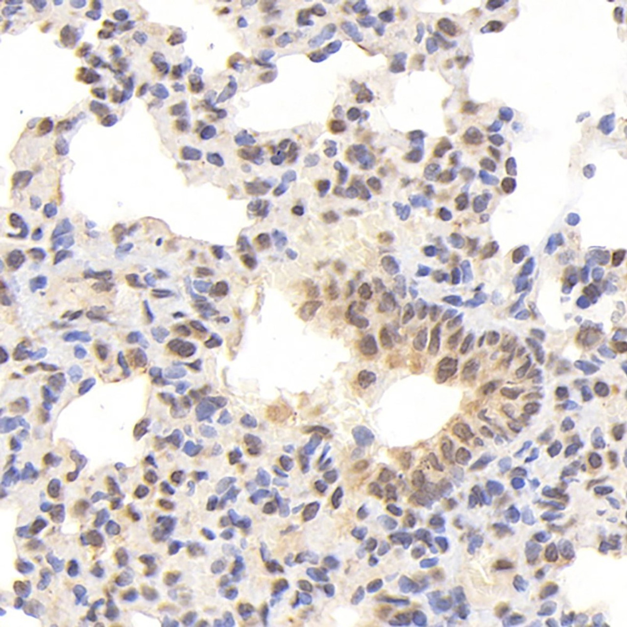 Immunohistochemistry analysis of paraffin-embedded rat lung  using ATF6 Polyclonal Antibody at dilution of 1:400.