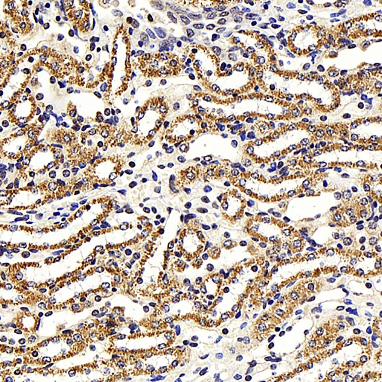 Immunohistochemistry analysis of paraffin-embedded mouse kidney  using NFKBIB Polyclonal Antibody at dilution of 1:300.
