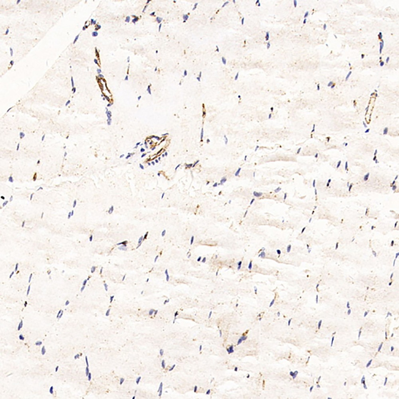 Immunohistochemistry analysis of paraffin-embedded Rat skeletal muscle   using CD31 Monoclonal Antibody at dilution of 1:200.