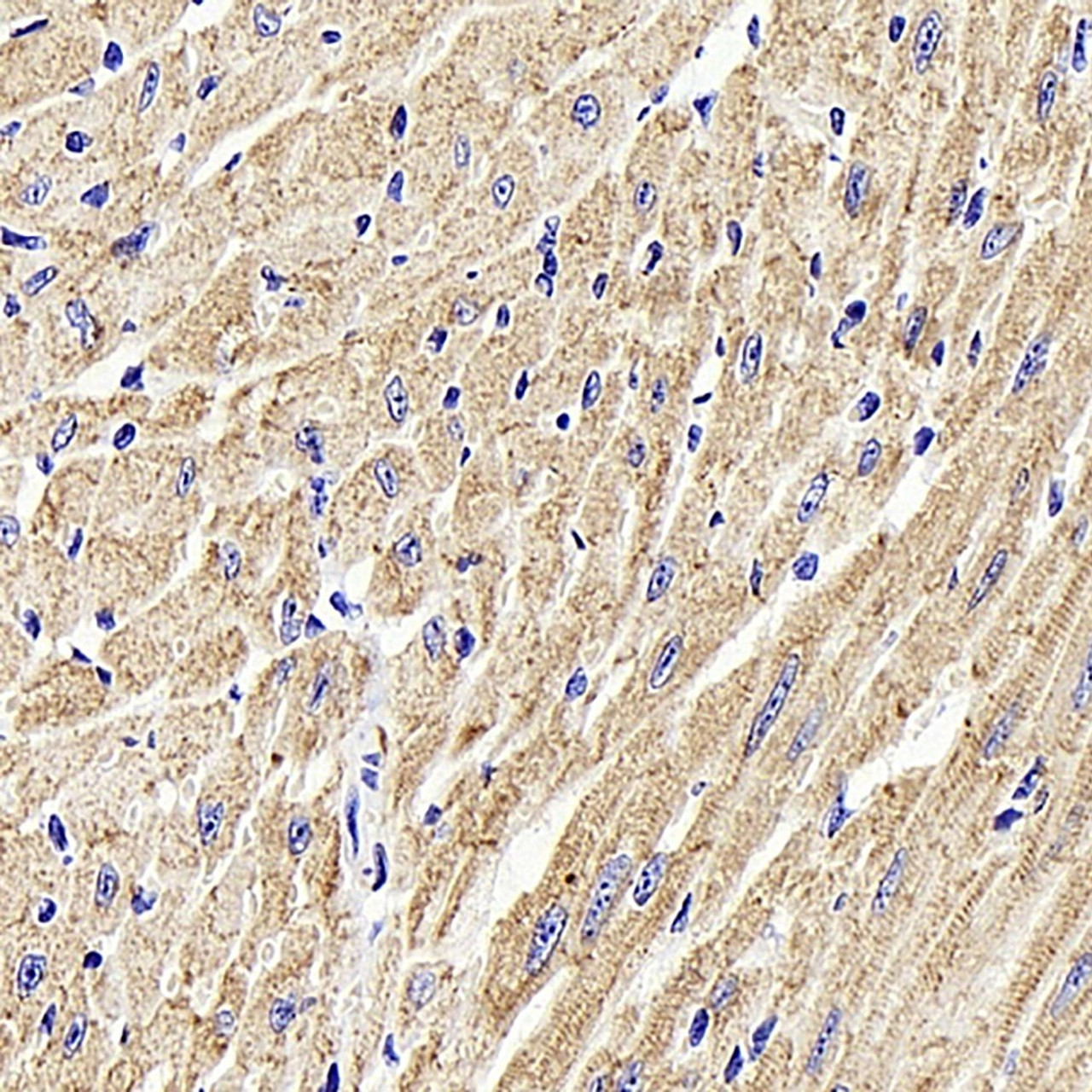 Immunohistochemistry analysis of parafffin-embedded mouse heart  using Desmin Polyclonal Antibody at dilution of 1:1000.