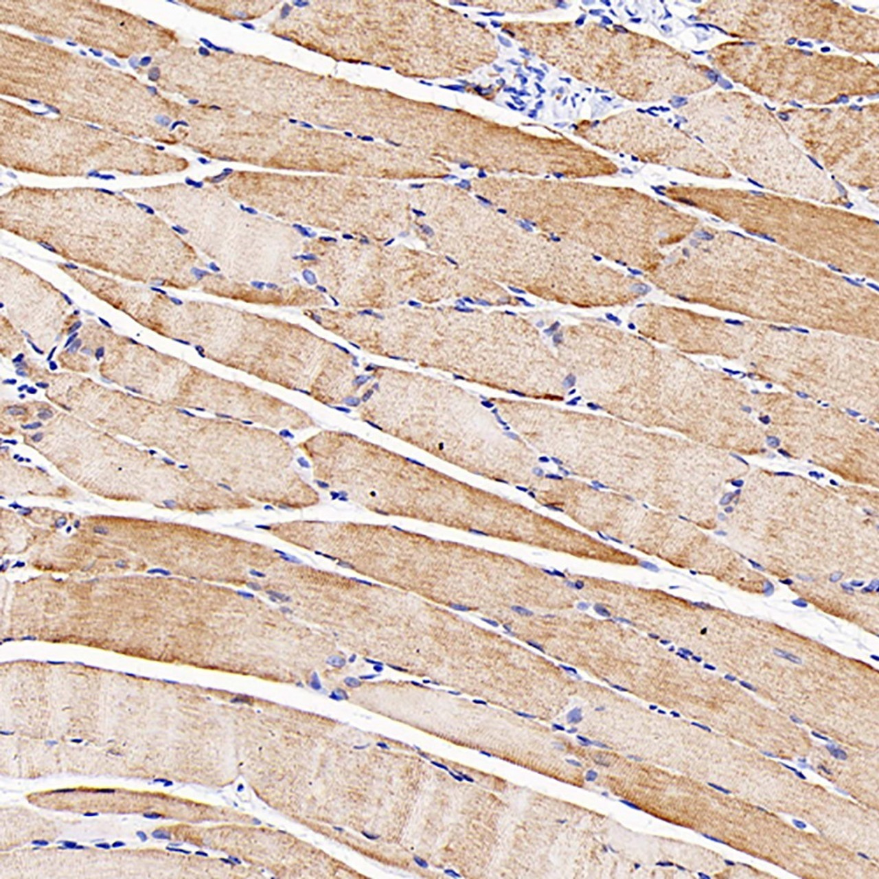 Immunohistochemistry analysis of parafffin-embedded rat skeletal muscle  using Desmin Polyclonal Antibody at dilution of 1:1000.