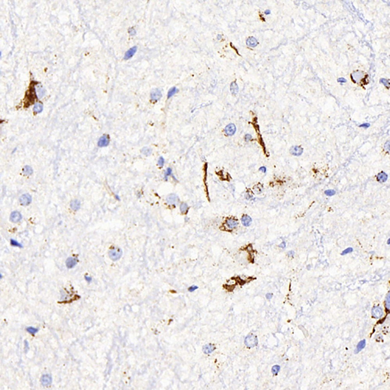 Immunohistochemistry analysis of paraffin-embedded rat spinal marrow  using DLL1 Polyclonal Antibody at dilution of 1:200.