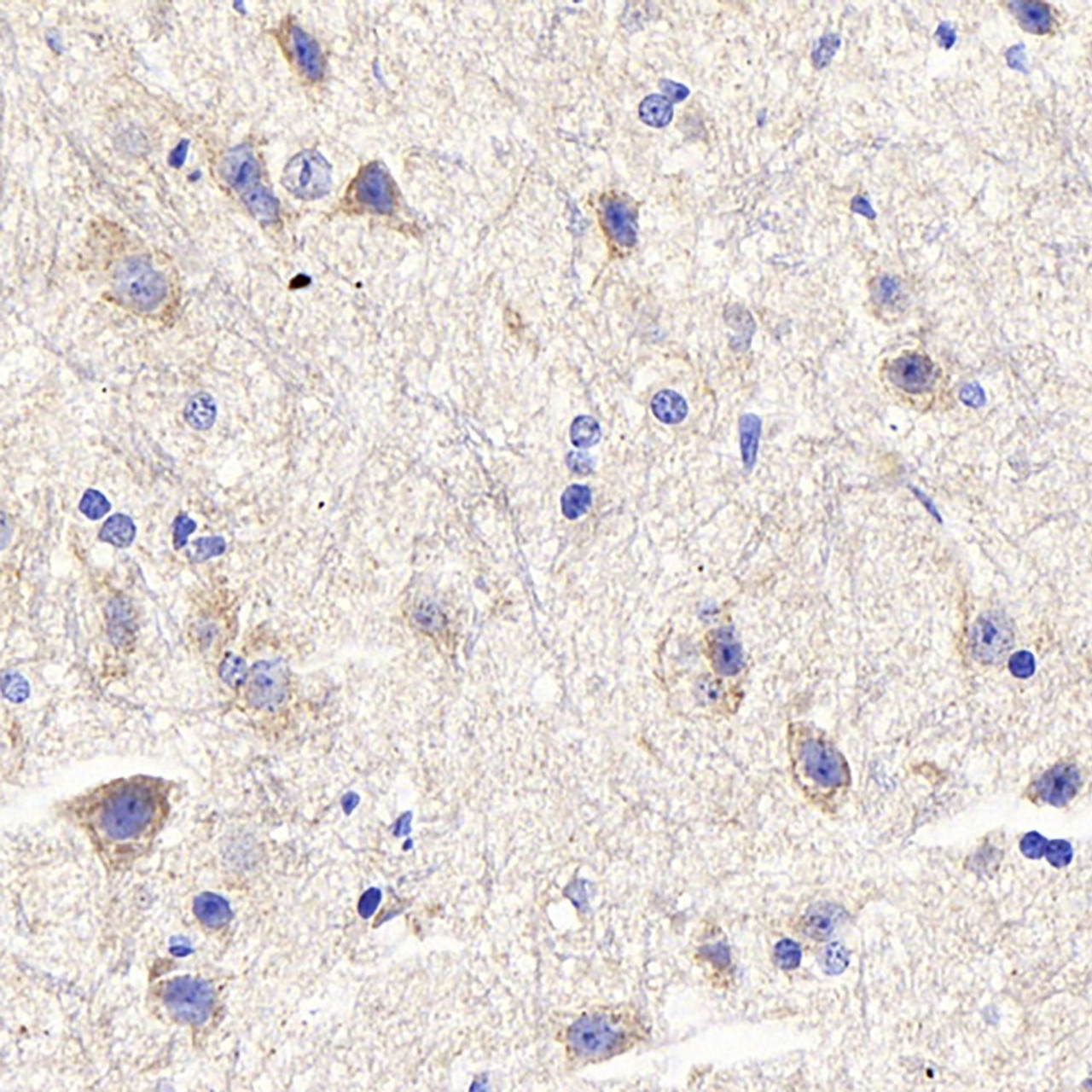 Immunohistochemistry analysis of paraffin-embedded mouse spinal marrow  using DLL3 Polyclonal Antibody at dilution of 1:300.