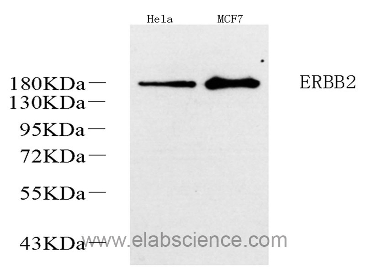 Western Blot analysis of various samples using ERBB2 Polyclonal Antibody at dilution of 1:1000.