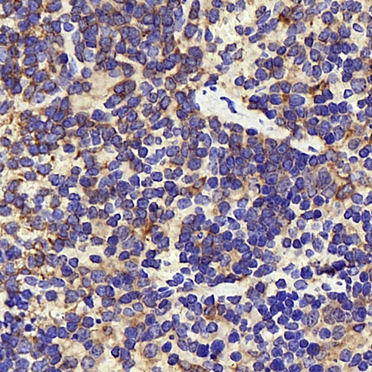 Immunohistochemistry analysis of paraffin-embedded mouse inflammation spleen  using INPP5D Polyclonal Antibody at dilution of 1:300.