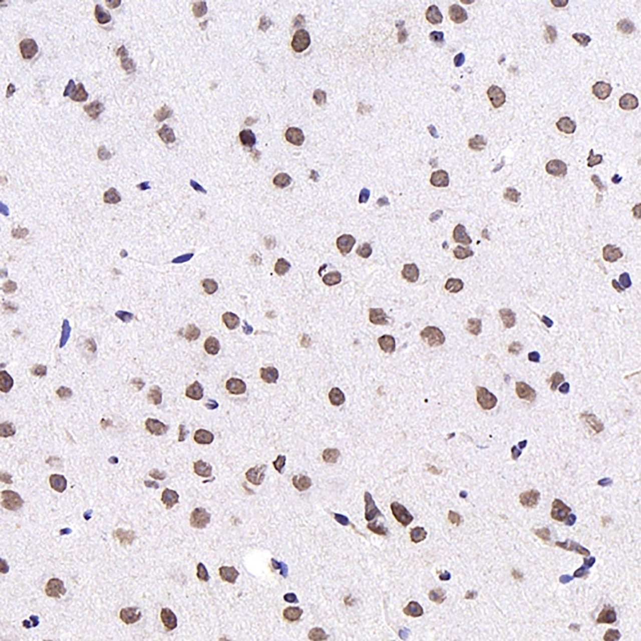 Immunohistochemistry analysis of paraffin-embedded mouse brain  using c-Fos Monoclonal Antibody at dilution of 1:1000.