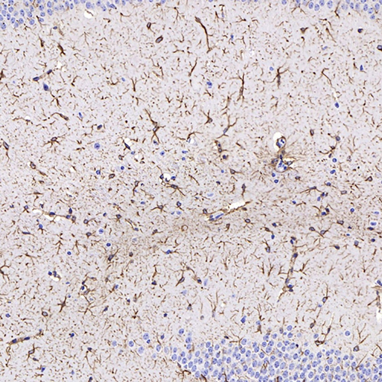 Immunohistochemistry analysis of paraffin-embedded mouse brain  using GFAP Monoclonal Antibody at dilution of 1:400.