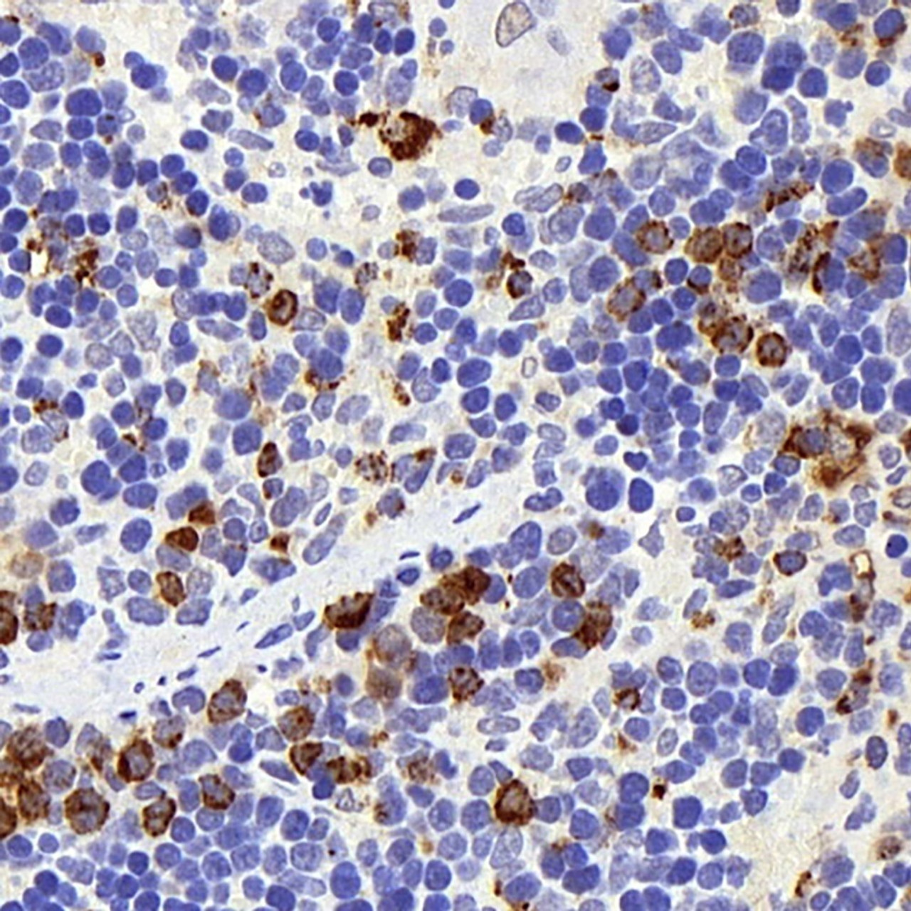 Immunohistochemistry analysis of parafffin-embedded rat spleen  using Lysozyme Polyclonal Antibody at dilution of 1:400.