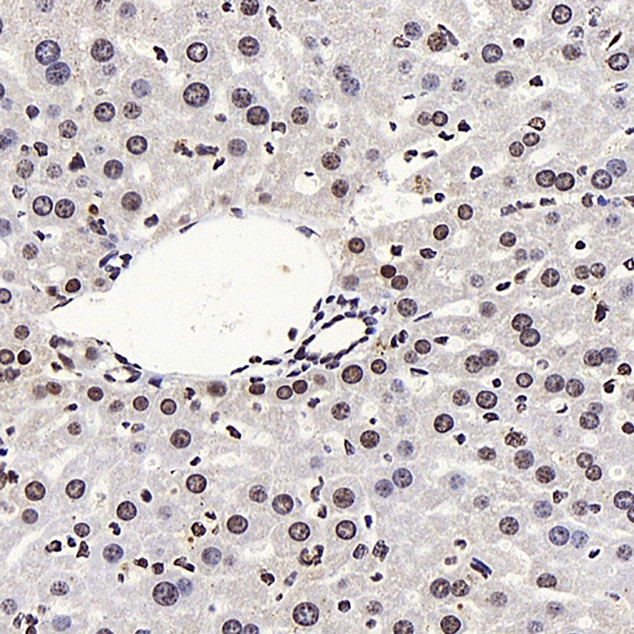 Immunohistochemistry analysis of paraffin-embedded mouse liver  using LXR alpha Polyclonal Antibody at dilution of 1:400.