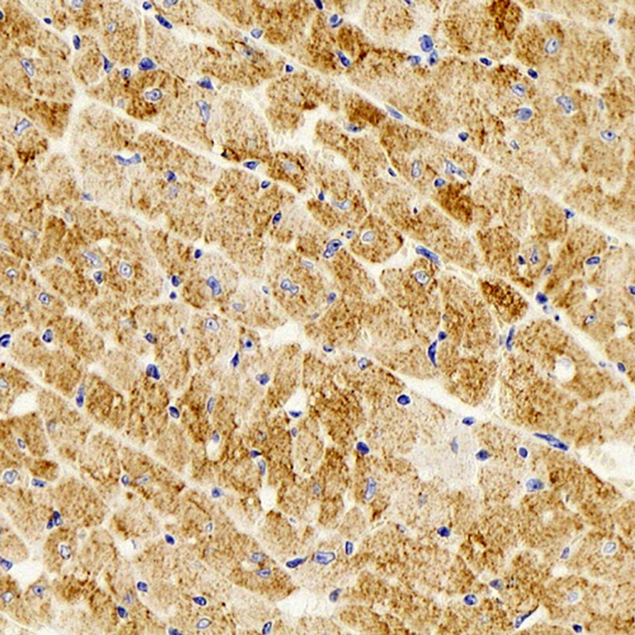 Immunohistochemistry analysis of parafffin-embedded mouse heart  using Desmin Monoclonal Antibody at dilution of 1:300.