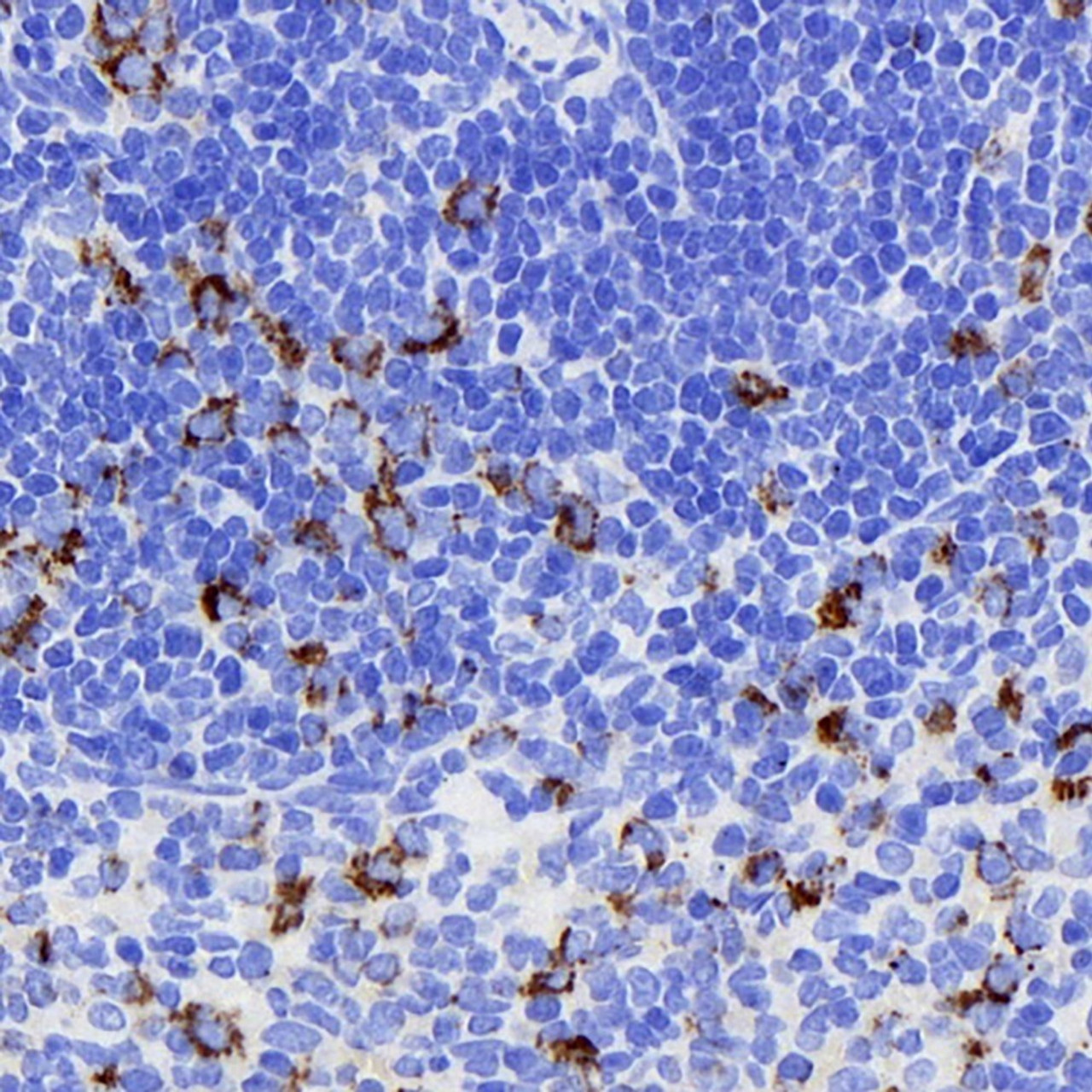 Immunohistochemistry analysis of paraffin-embedded rat spleen  using CD284 Monoclonal Antibody at dilution of 1:400.