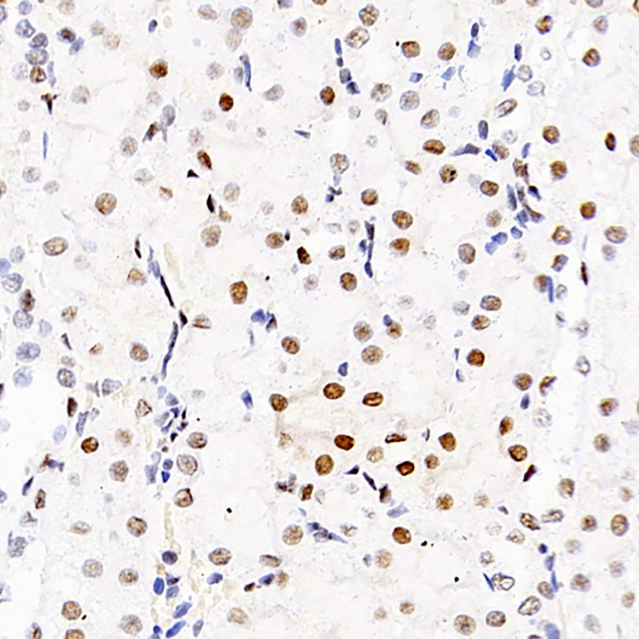 Immunohistochemistry analysis of paraffin-embedded Rat kidney  using HDAC2 Polyclonal Antibody at dilution of 1:1000.