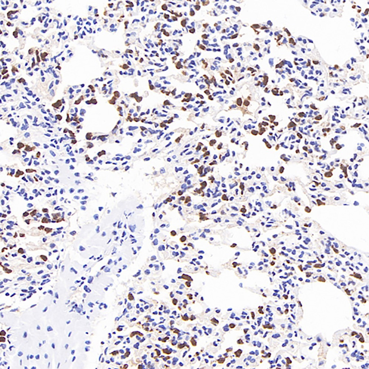 Immunohistochemistry analysis of paraffin-embedded mouse inflammatory lung  using MMP9 Monoclonal Antibody at dilution of 1:400.
