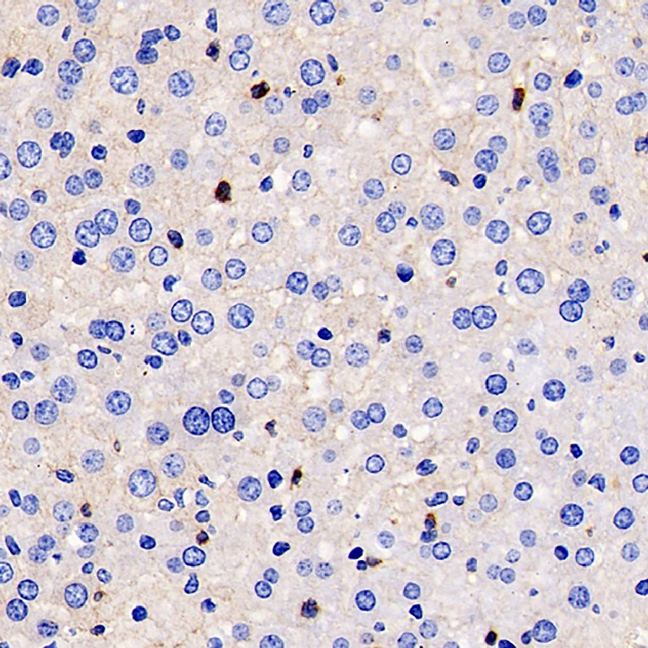 Immunohistochemistry analysis of paraffin-embedded mouse inflammatory liver  using MMP9 Monoclonal Antibody at dilution of 1:400.