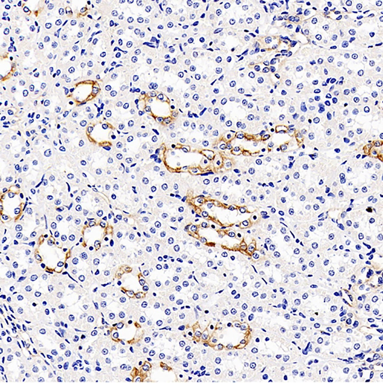 Immunohistochemistry analysis of paraffin-embedded rat kidney  using MMP9 Monoclonal Antibody at dilution of 1:300.