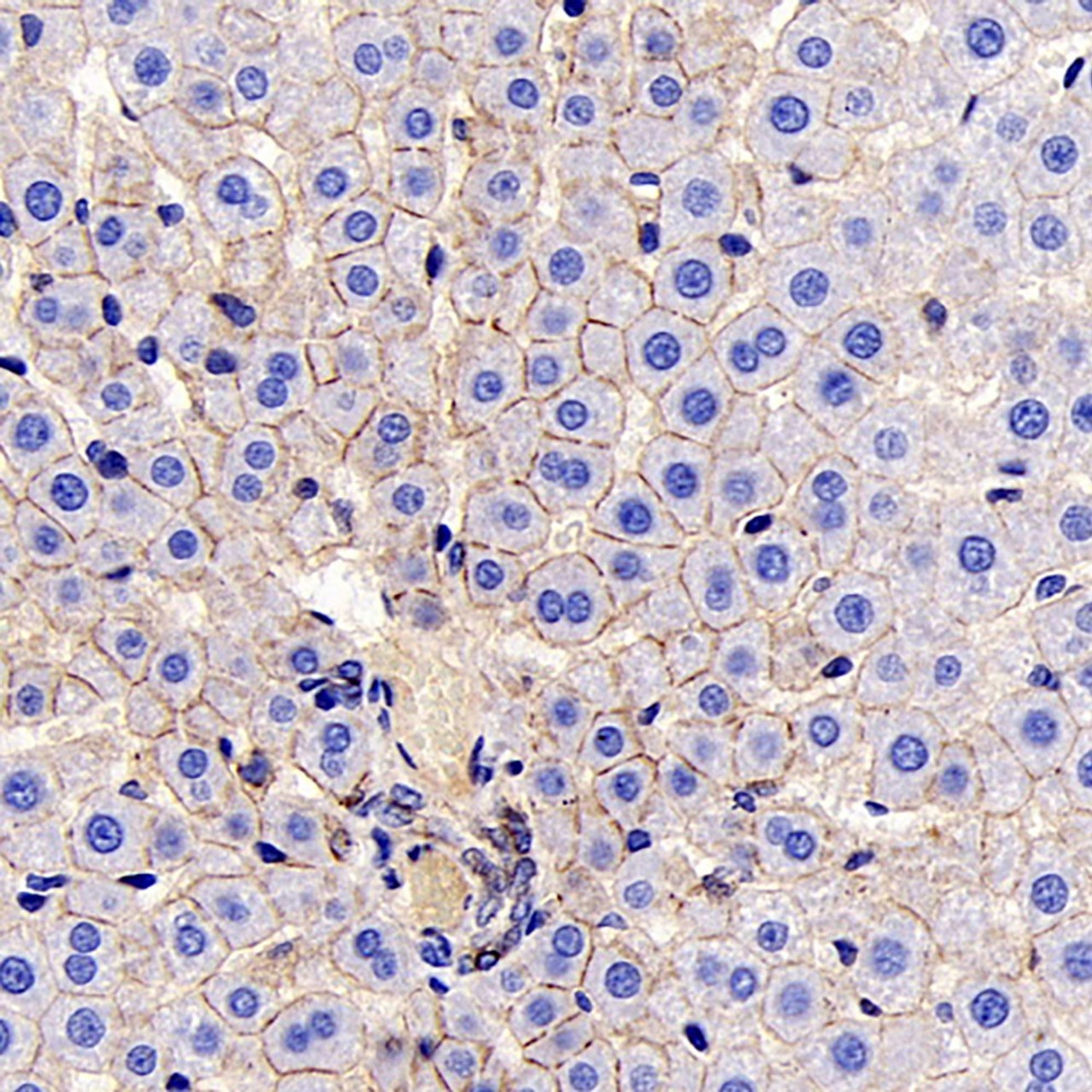 Immunohistochemistry analysis of paraffin-embedded mouse liver  using E-Cadherin Monoclonal Antibody at dilution of 1:300.