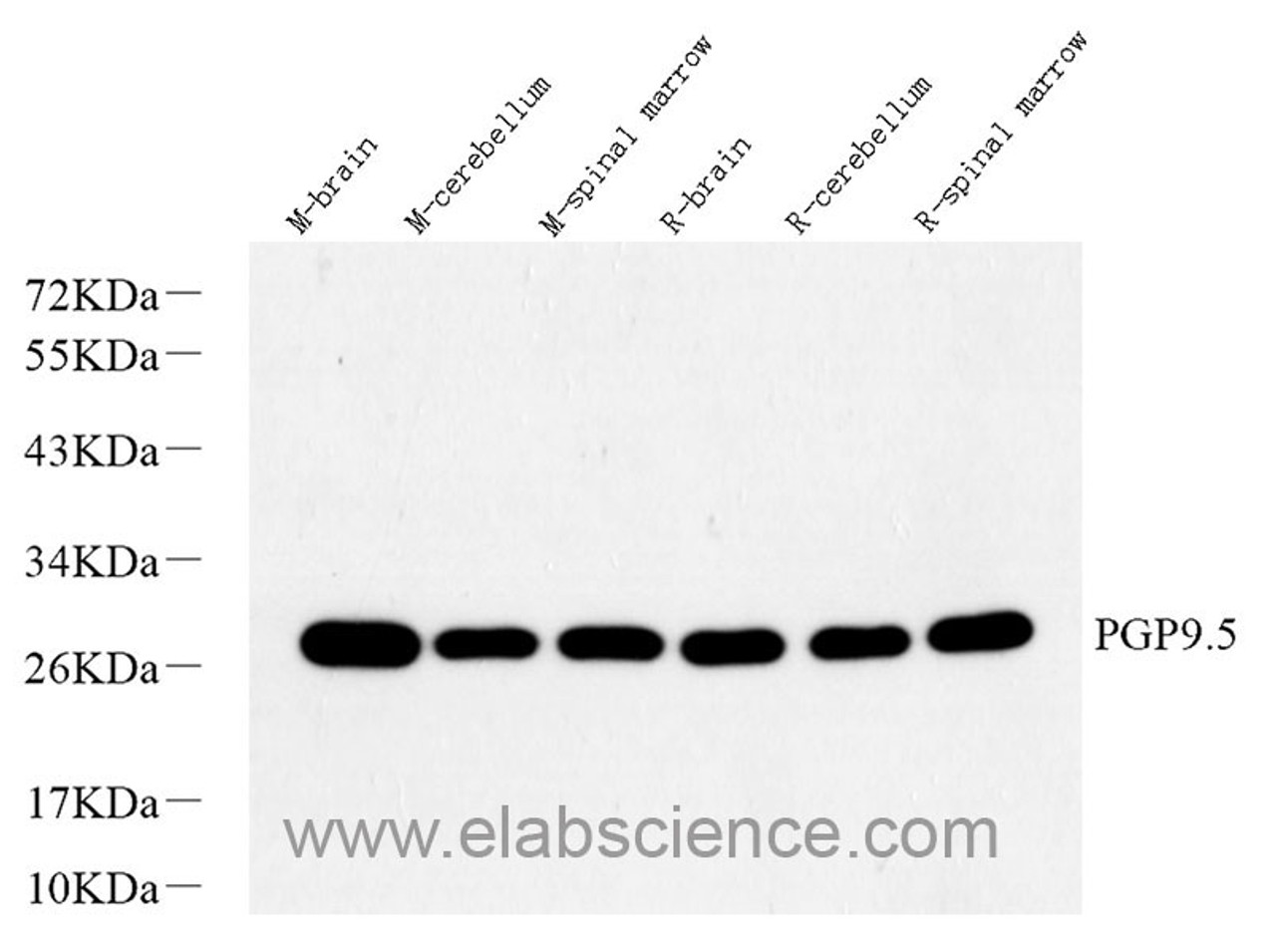 Western Blot analysis of various samples using PGP 9.5 Polyclonal Antibody at dilution of 1:1000.