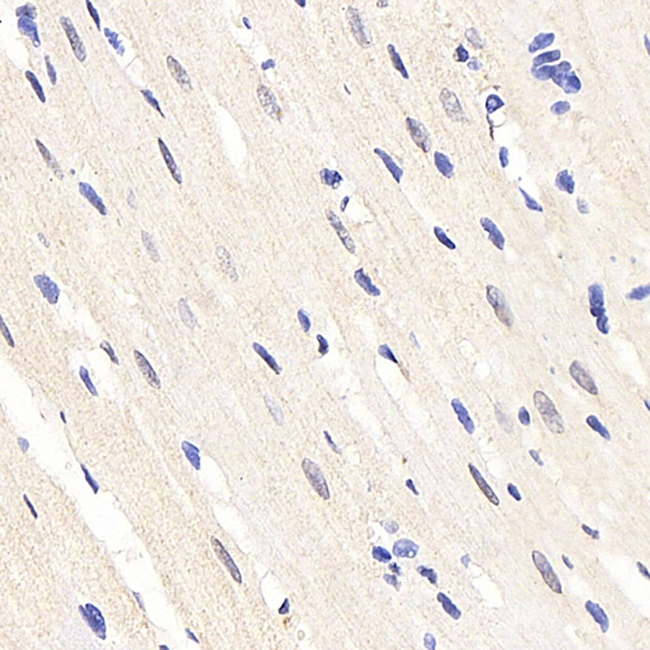 Immunohistochemistry analysis of paraffin-embedded rat heart  using HES2 Polyclonal Antibody at dilution of 1:200.