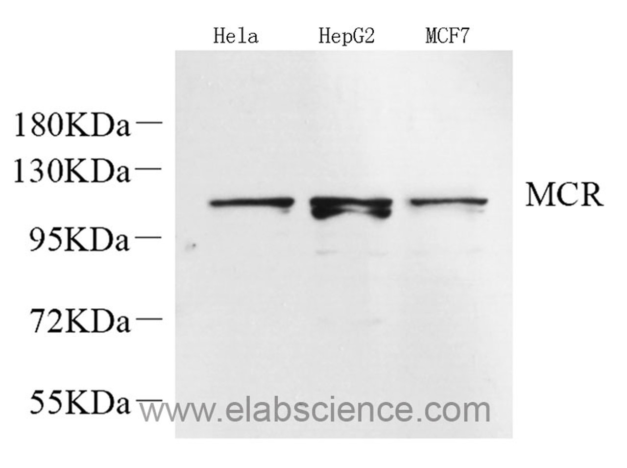 Western Blot analysis of various samples using Mineralocorticoid receptor Polyclonal Antibody at dilution of 1:600.